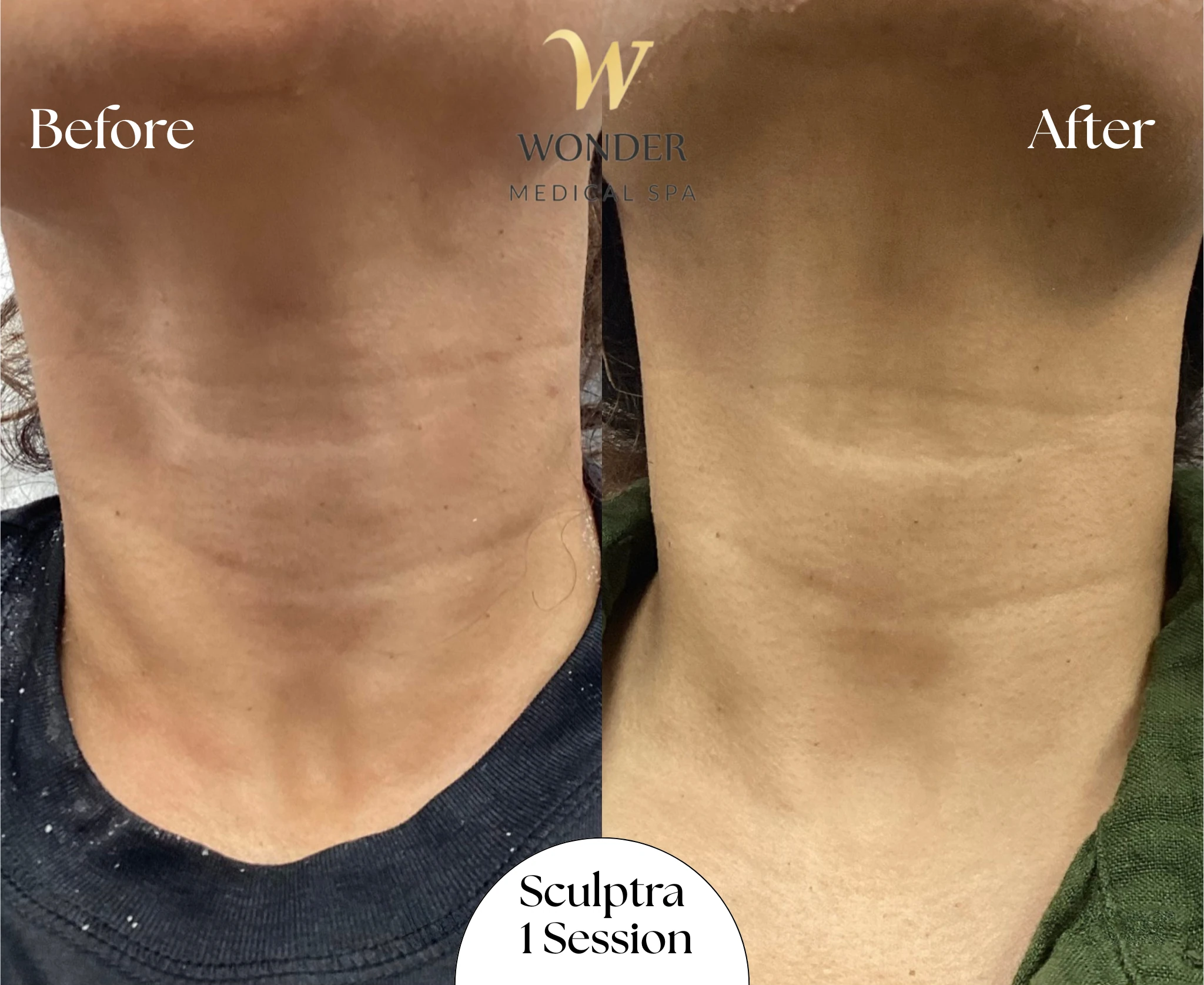 Scultra 1 Session Result